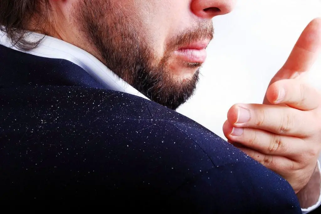 Beard Hair Loss Fungus Beard Hair Loss Fungus