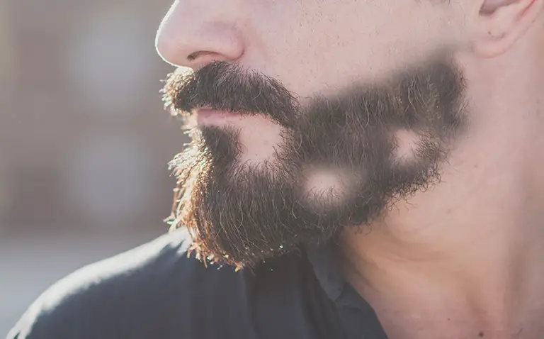 Beard rogaine bald spots for How to