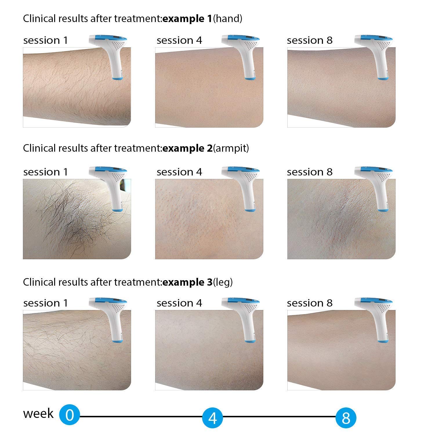 The Right Hair Removal Machine For Men My Beard Gang