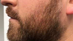 Can I bleach My beard? — A friendly guide to help you out