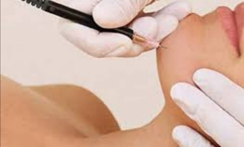 Home Electrolysis Reviews Consumer Reports Home Electrolysis Reviews Consumer Reports
